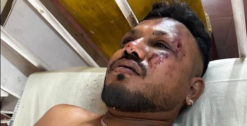 ഇല്ല; എല്ലാവരും മരിച്ചിട്ടില്ല: വിശ്വഷ് പരിക്കേറ്റ് ചികിത്സയിലുണ്ട്