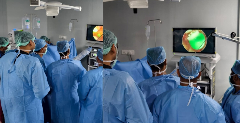 വയനാട് ഗവ. മെഡിക്കല്‍ കോളേജില്‍ ആര്‍ത്രോസ്‌കോപ്പിക് റൊട്ടേറ്റര്‍ കഫ് റിപ്പയര്‍ വിജയകരം