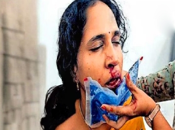 ക്ലാസിനിടയിൽ കംപ്യൂട്ടർ ഗെയിം കളിച്ചതു ചോദ്യം ചെയ്ത മലയാളി അധ്യാപികയുടെ മൂക...